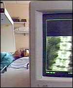 Bone density scan
