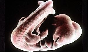 Foetus