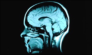 Brain scan generic