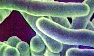 Tuberculosis