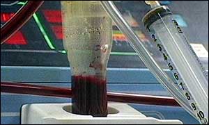 Dialysis