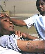 Aids patient 