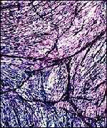 Blood vessels