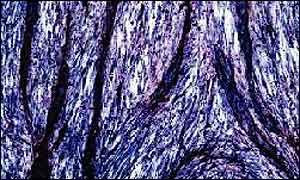 Blood vessels 