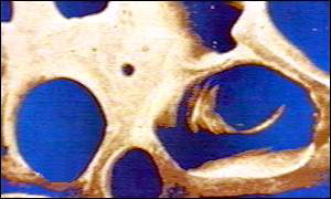 Bones generic