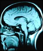 Brain