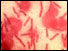 Anthrax spores