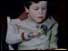 Child victim of thalidomide