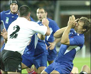 Fabien Galthie of France holds his face after being punched by Fiji's Greg Smith