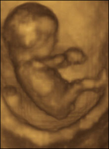 10 weeks gestation, 60mm from crown to rump.