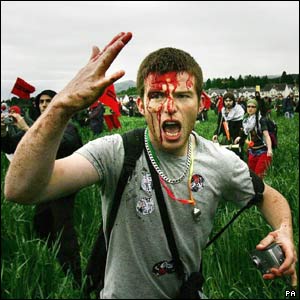 Injured protester