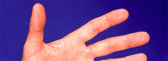 Left hand