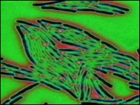 MRSA bacteria