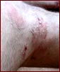 Ste's leg
