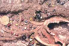 Human remains