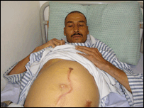 زردی سياه