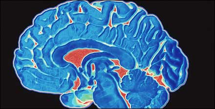 cerebro1.jpg