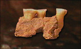 Jawbone