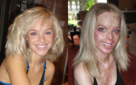 before_and_after.jpg
