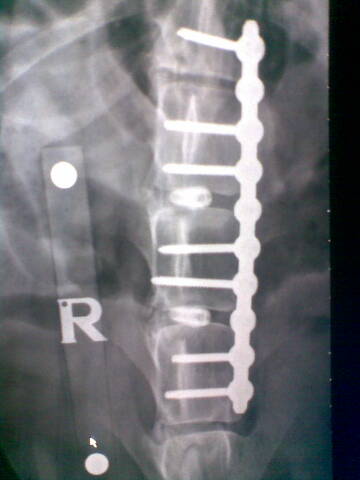 xray2.jpg