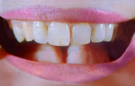 Teeth