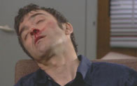 Lewis unconscious