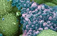 Gonorrhea virus