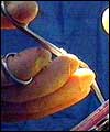 Surgery