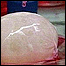 مثانه