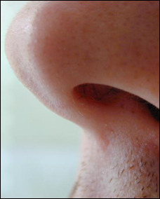 A nose
