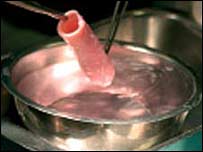 Claudia Castillo's new Trachea