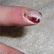 080818_carrie_injury.jpg