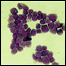 Células de leucemia