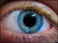 Eye