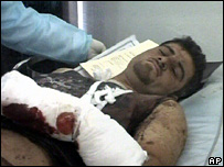 Man injuried after blast in Iraq