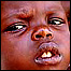 Garota sudanesa