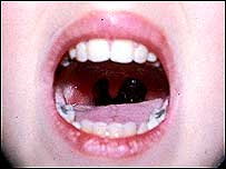 Mouth