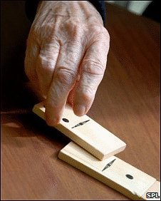 _47233385_alzheimers.jpg