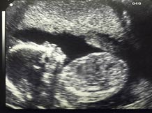 ethicsindex_abortion.jpg