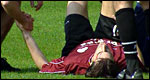 A football injury
