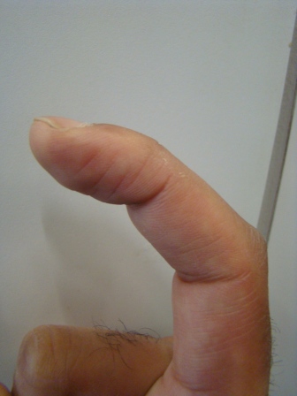 L-FINGER3.JPG