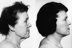 Cosmetic Surgery