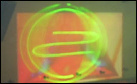 Lasers