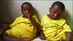 Conjoined twins Precious and Blessing