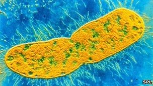 superbug.jpg