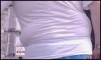 Obesity, a looming health crisis