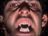 A vampire