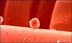 Kmenové buňky mají schopnost vrůst do lidské tkáně