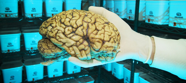 Brain in a brain bank
