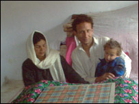 گازگرفتگی
